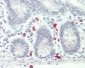 CD40L Antibody (N-Terminus)